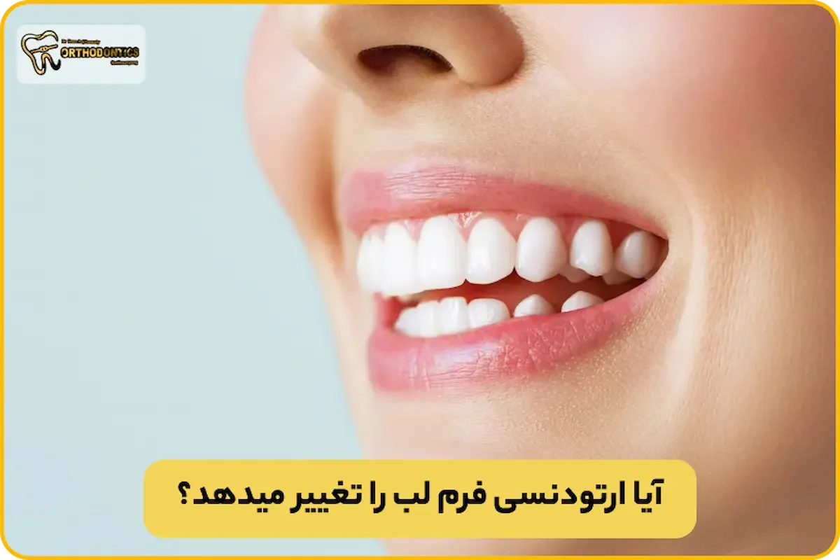 تغییر فرم لب بعد از ارتودنسی