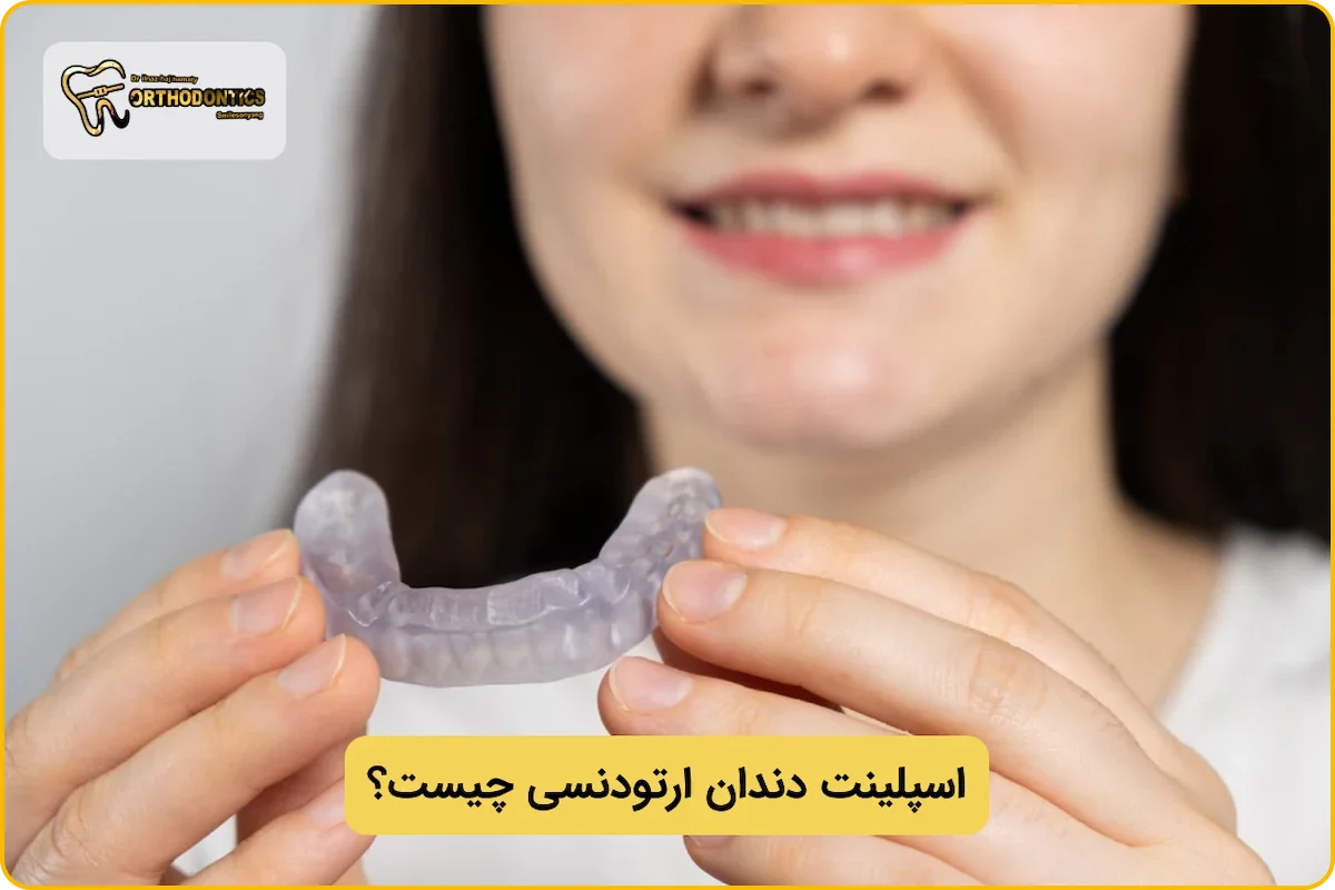 اسپلینت دندان ارتودنسی