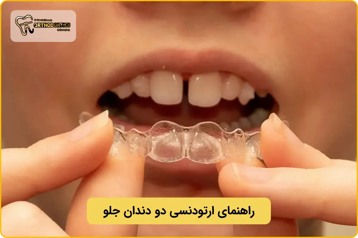 ارتودنسی دو دندان جلو