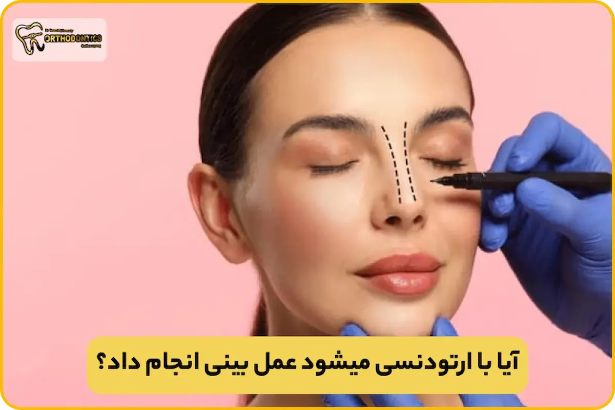 ارتودنسی بعد از عمل بینی