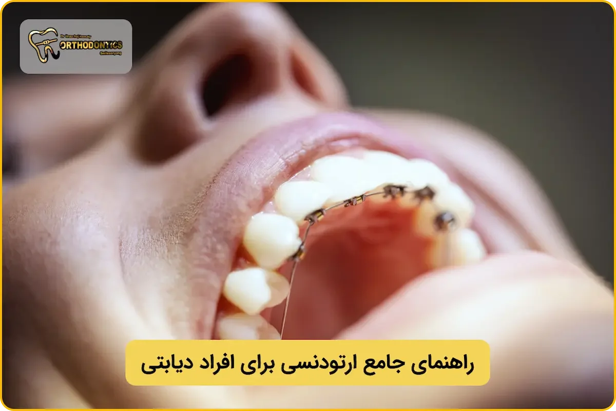 ارتودنسی برای افراد دیابتی