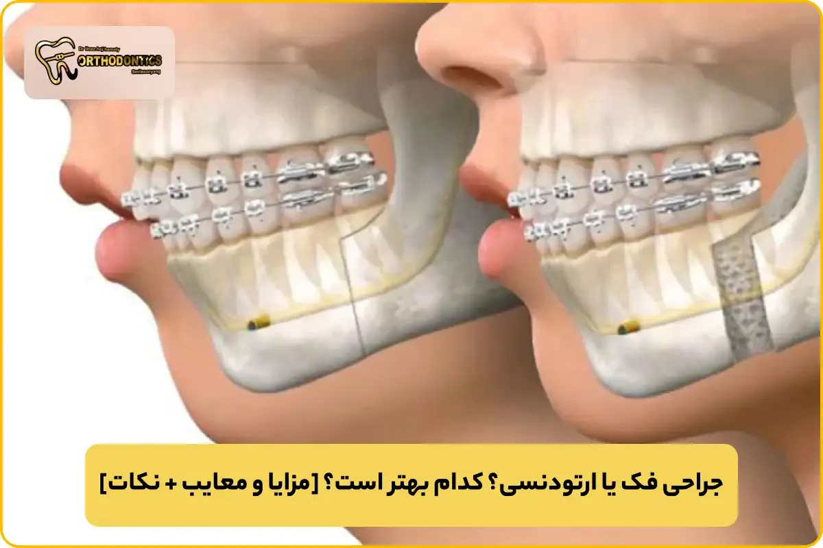 جراحی فک یا ارتودنسی