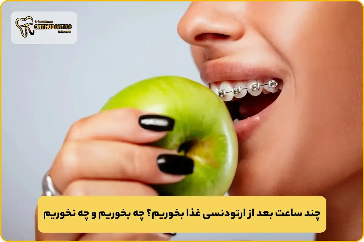 چند ساعت بعد از ارتودنسی غذا بخوریم؟