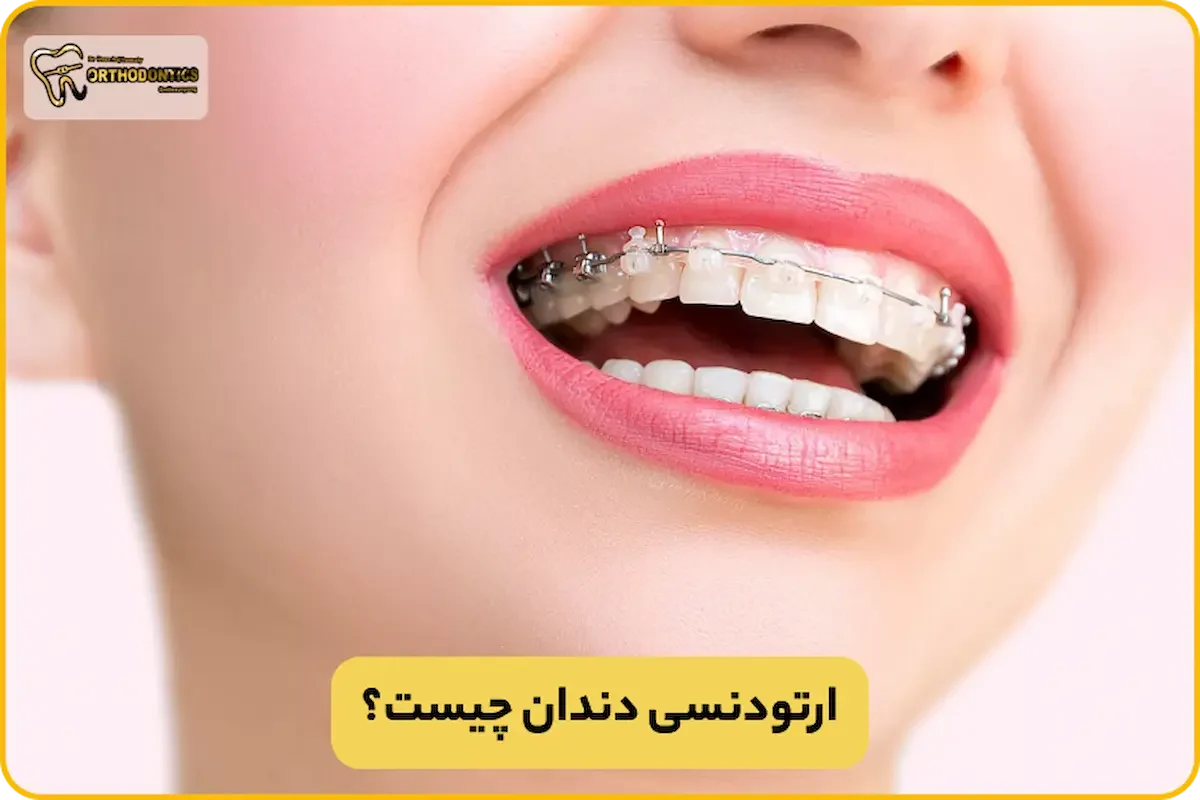 ارتودنسی