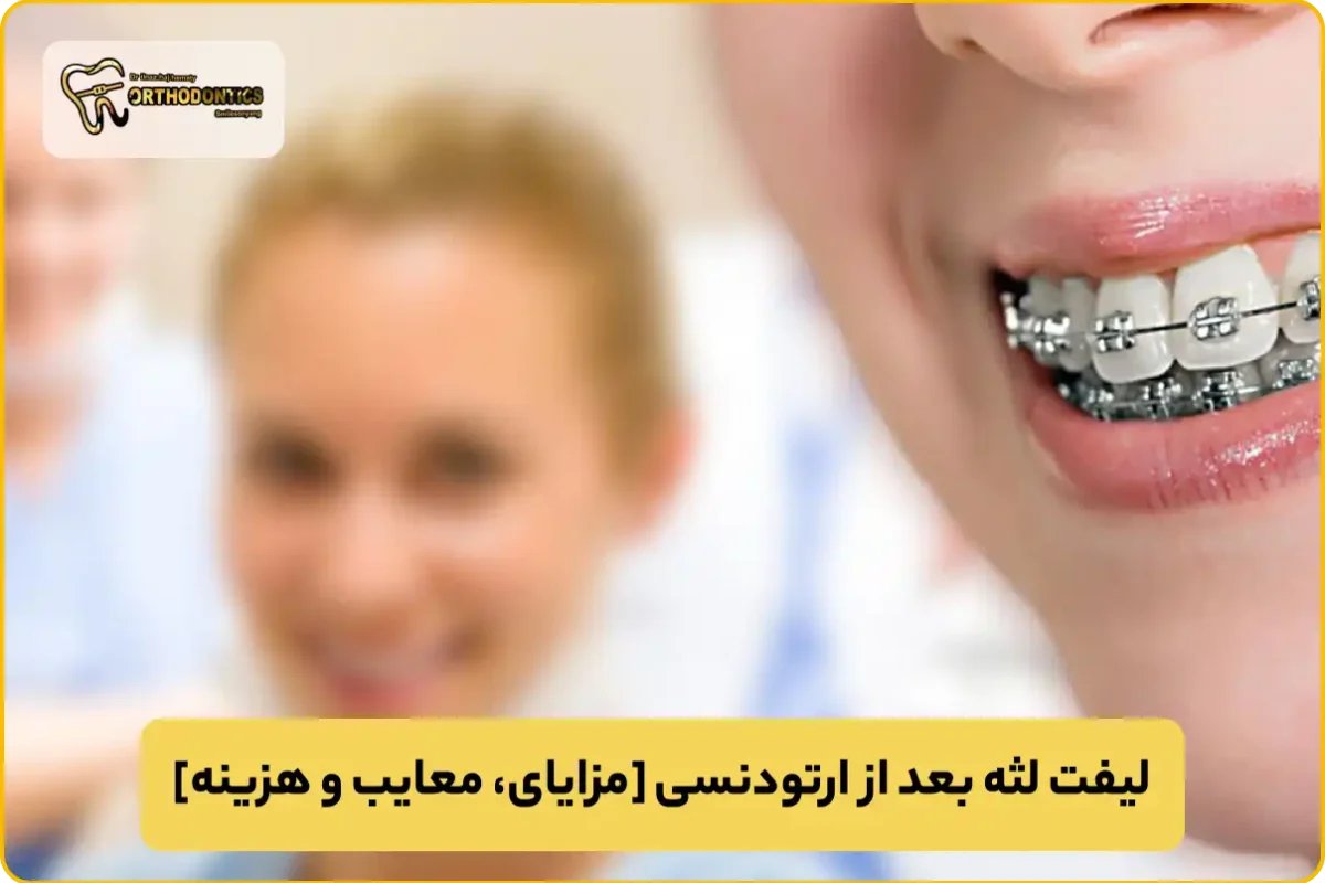 لیفت لثه بعد از ارتودنسی