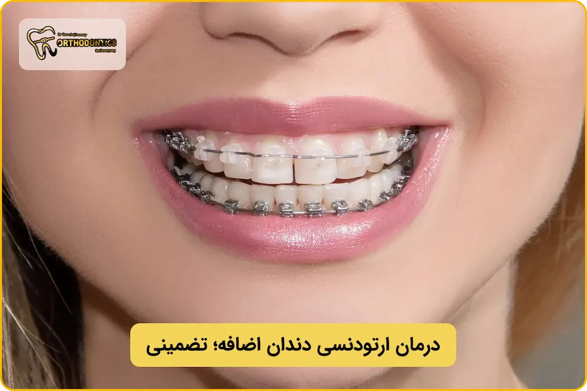 ارتودنسی دندان اضافه؛ از شروع تا درمان