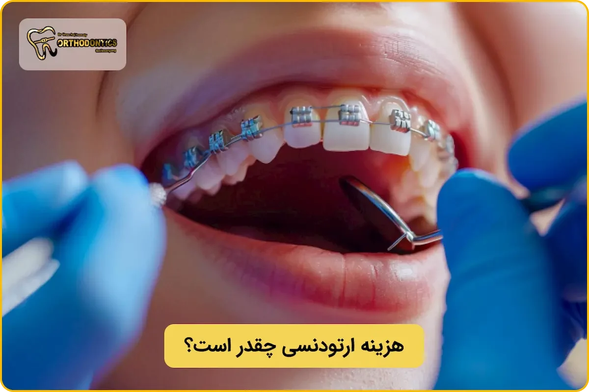 قیمت ارتودنسی چقدر است